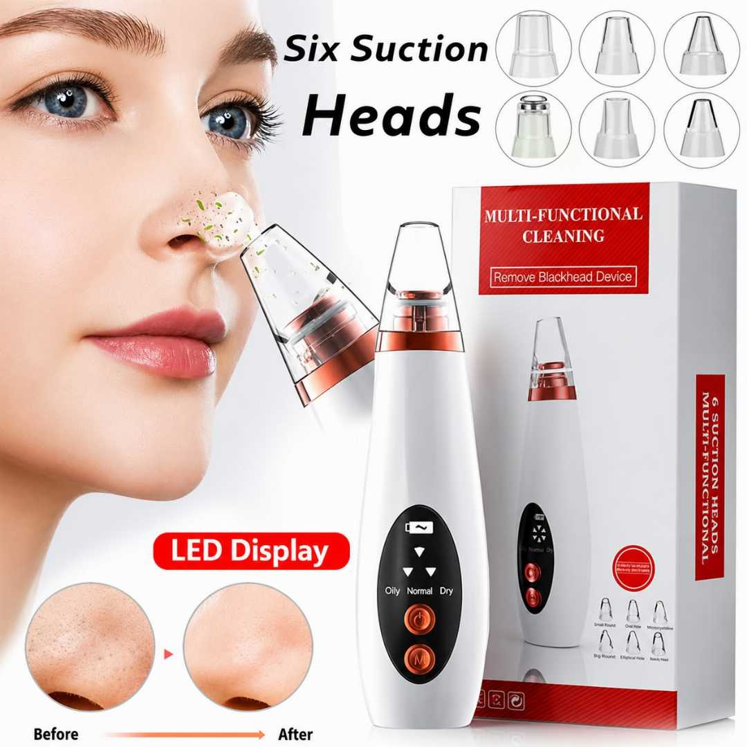 Multifunctional,Blackhead,Remover,&,Skin,Vacuum,Pore,Cleaner