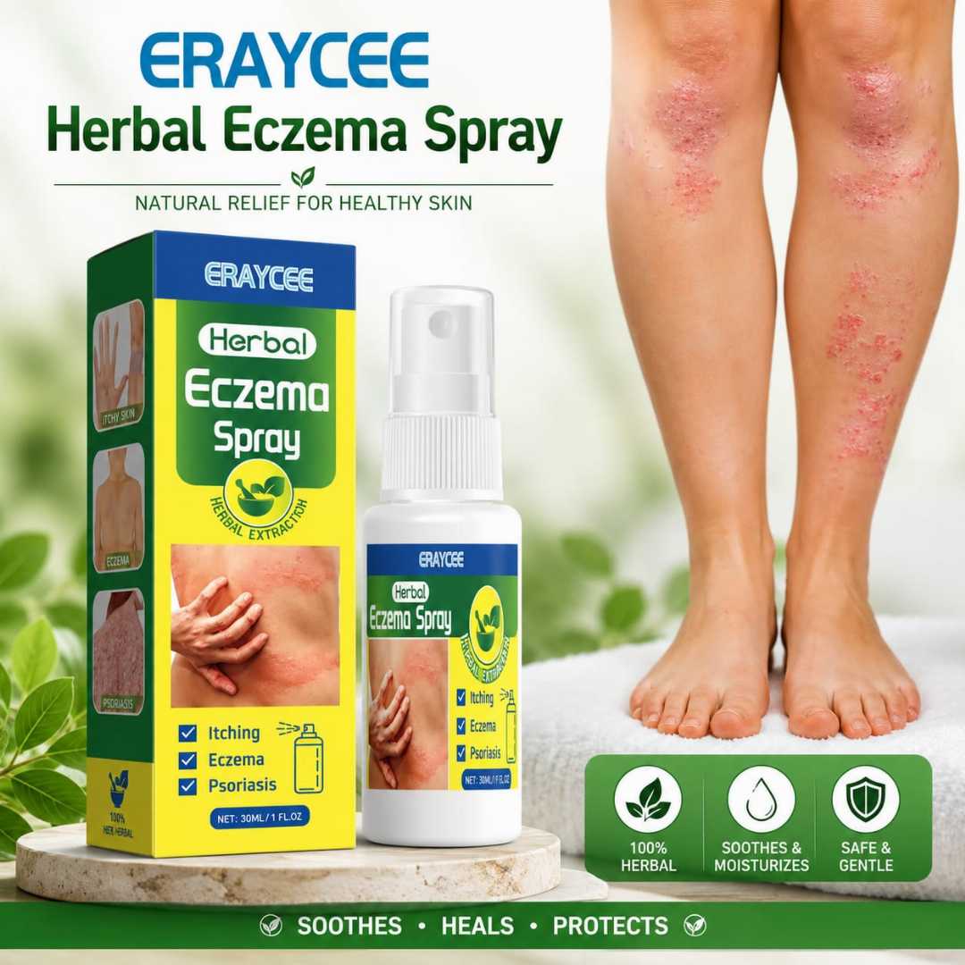Eraycee,Herbal,Eczema,Spray